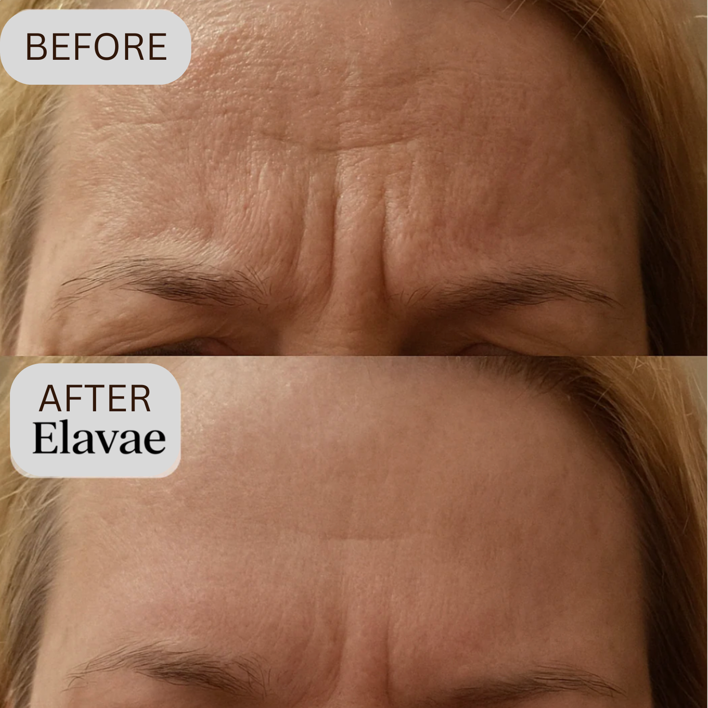 Elavae™ Silicone Collagen Sheets