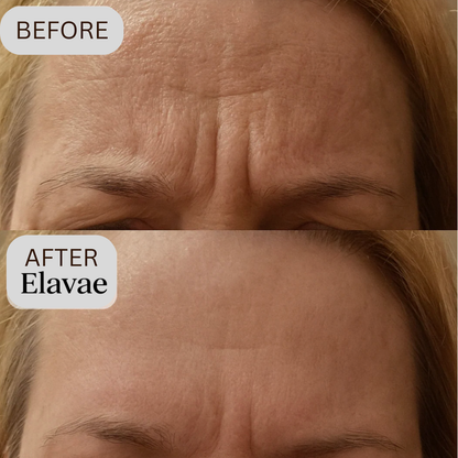 Elavae™ Silicone Collagen Sheets