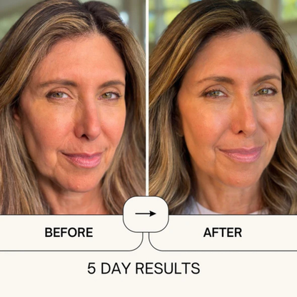 Elavae™ Silicone Collagen Sheets