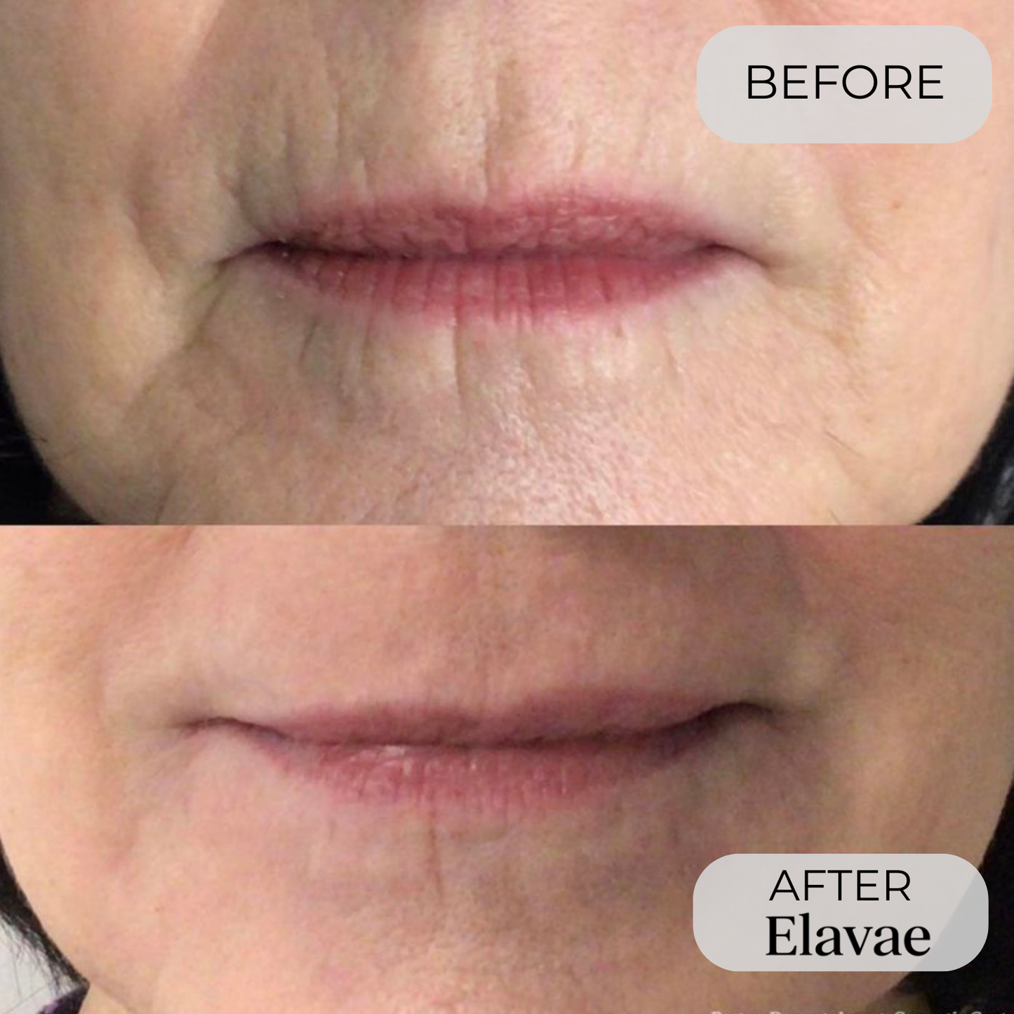 Elavae™ Silicone Collagen Sheets