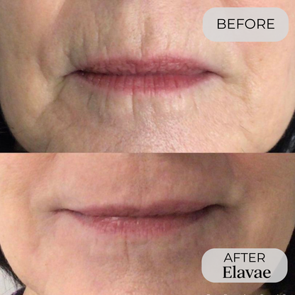 Elavae™ Silicone Collagen Sheets