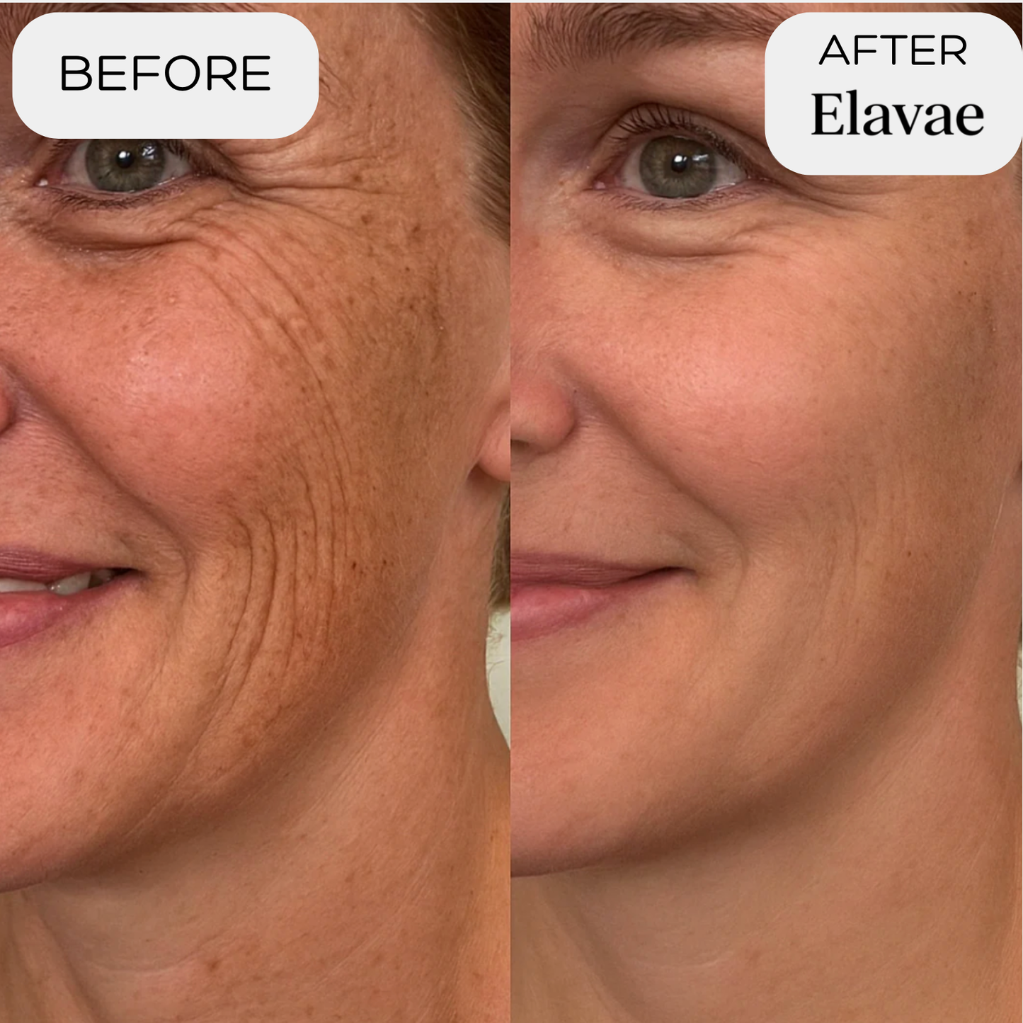 Elavae™ Silicone Collagen Sheets